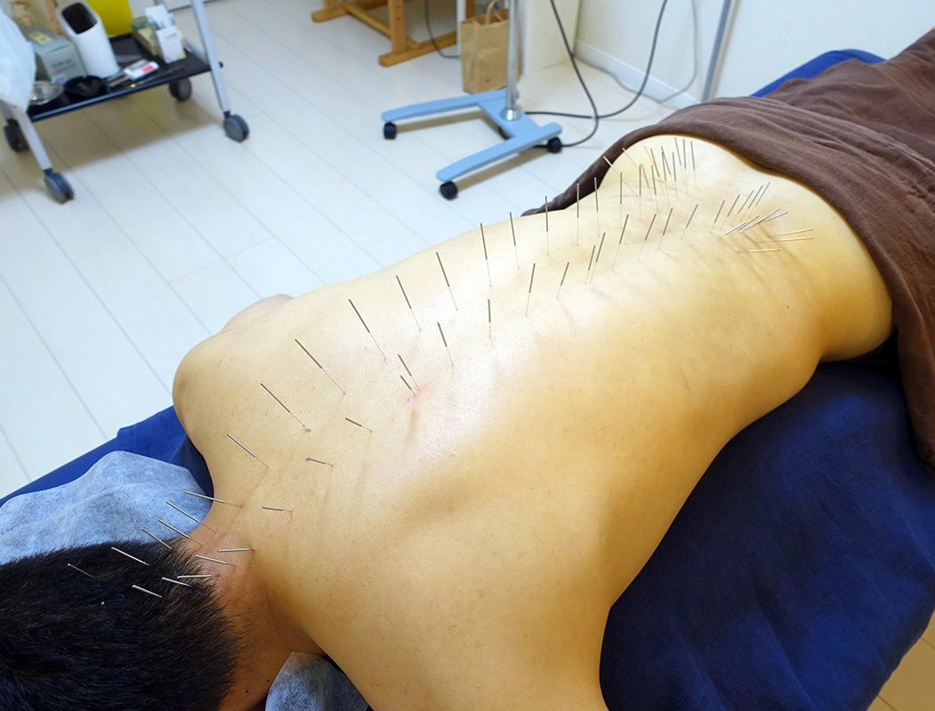 はり・灸・マッサージ みつば治療院｜西東京市田無の鍼灸治療院